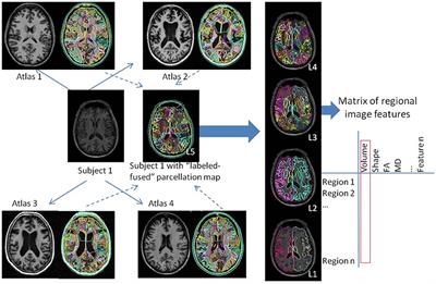 Brain MRI Pattern Recognition Translated to Clinical Scenarios